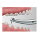 Z890L_teeth_SpeeCurve_230215